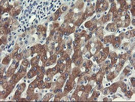 FTCD / 58K Golgi Protein Antibody (clone OTI1A7)