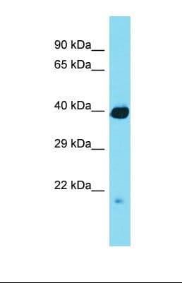 RCBTB1 Antibody (aa145-194)