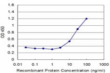 ALX1 Antibody (clone 2A10)