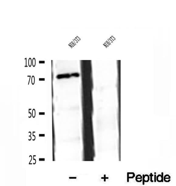 Polyclonal Rabbit anti-Human SPG20 / SPARTIN Antibody (IHC, WB)