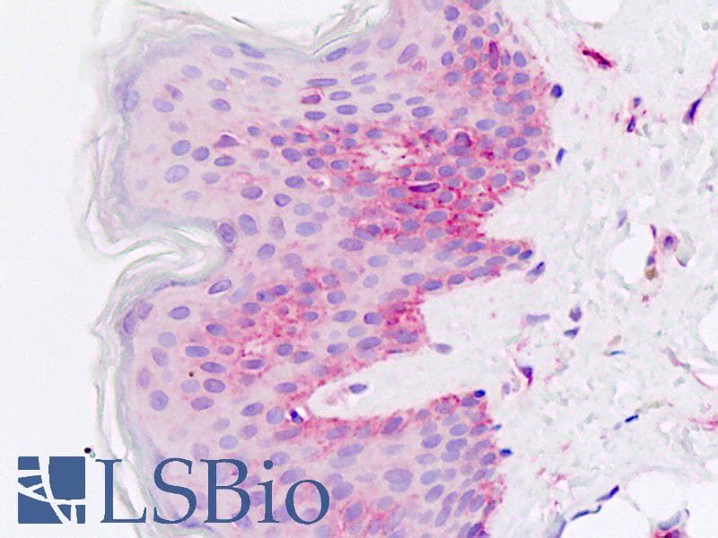 IHC-plus™ CDH13 / Cadherin 13 Antibody (aa146-174)