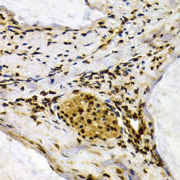 IFIH1 / MDA5 Antibody