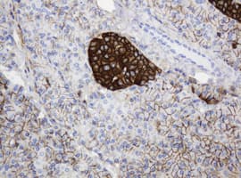 CD99 Antibody (clone OTI3E8)