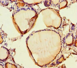 SCPEP1 / RISC Antibody