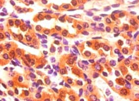 Polyclonal Rabbit anti-Human FABP3 / H-FABP Antibody (IHC, WB)