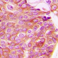 RHOA Antibody (C-Terminus)
