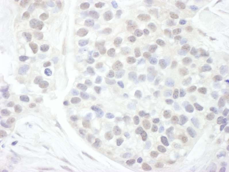 CCNT1 / Cyclin T1 Antibody (aa625-675)