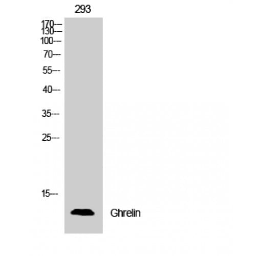 Polyclonal Rabbit anti-Human Ghrelin Antibody (Internal, IHC, WB)