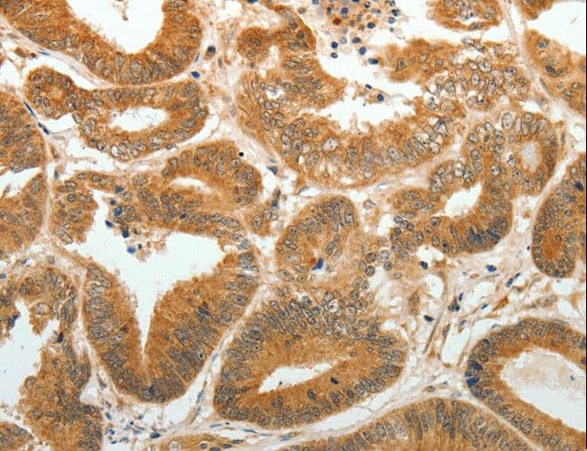DDH / AKR1C1 Antibody