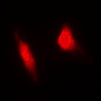 RACGAP1 / MGCRACGAP Antibody (Internal)