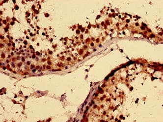 RBMY1A1 Antibody