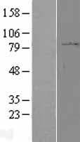 Human PPP2R1B Protein (Over-Expression Lysate Myc-DDK (Flag))