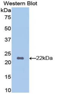 HBB / Hemoglobin Beta Antibody (aa1-147)