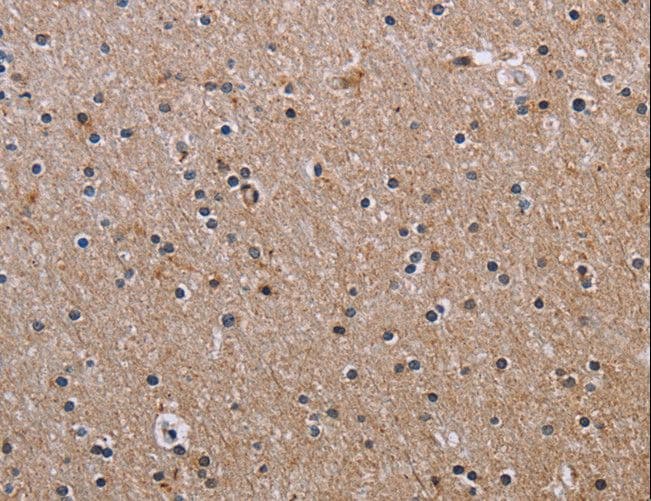 FCGR3A / CD16A Antibody