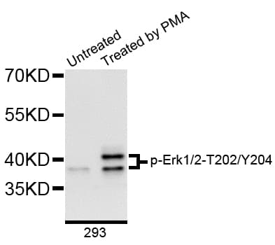 ERK1 + ERK2 Antibody (phospho-Thr202/Tyr204)