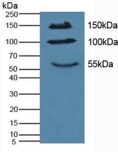 IL17RA Antibody (aa590-848, APC)