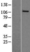 NASP Protein (Over-Expression Lysate Myc-DDK (Flag))