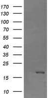 CTAG1B / NY-ESO-1 Antibody (clone OTI5B9)