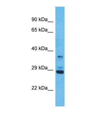 OR5V1 Antibody (C-Terminus)