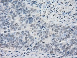 Monoclonal Mouse anti-Human CYPOR / POR Antibody (clone OTI1B11, IHC, IF, WB)