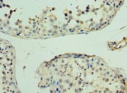 MAS1 / MAS Antibody (aa246-325)