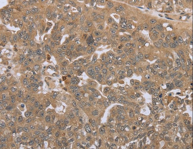 Polyclonal Rabbit anti-Human STMN2 + STMN3 + STMN4 Antibody (IHC)