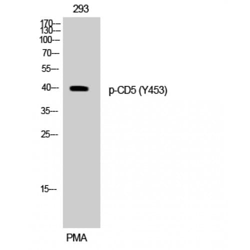 CD5 Antibody (390-470 aa)