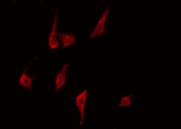 PRKCD / PKC-Delta Antibody (phospho-Tyr313)