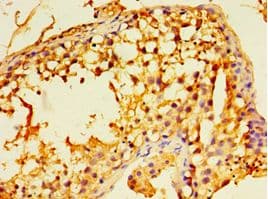 Polyclonal Rabbit anti-Human ECSIT Antibody (aa185-431, IHC, WB)