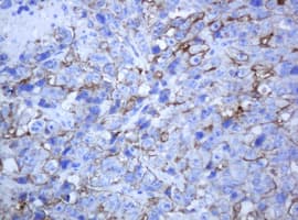 ABCB1 / MDR1 / P Glycoprotein Antibody (aa995-1280, clone 6H2, Carrier-free)