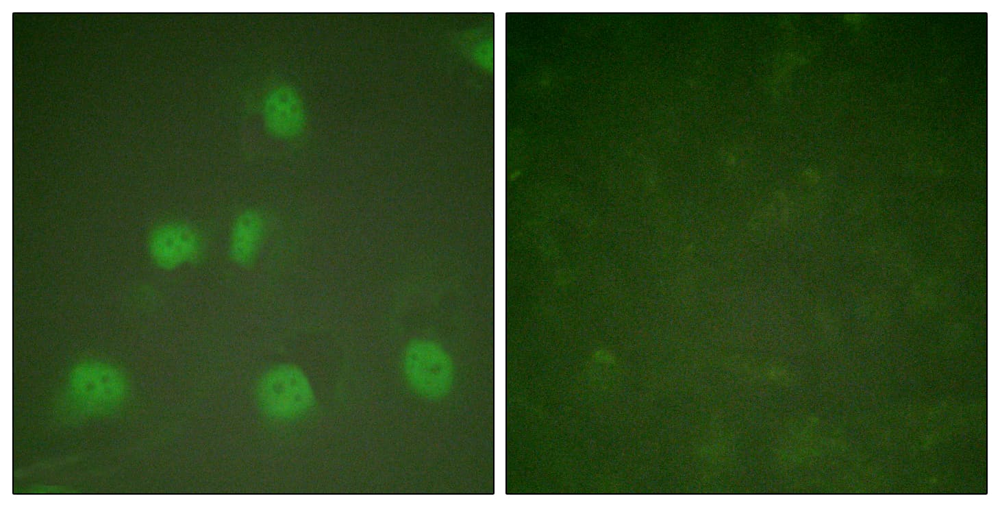 IHC-plus™ CUL1 / Cullin 1 Antibody (aa727-776)