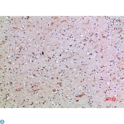 CD16 Antibody