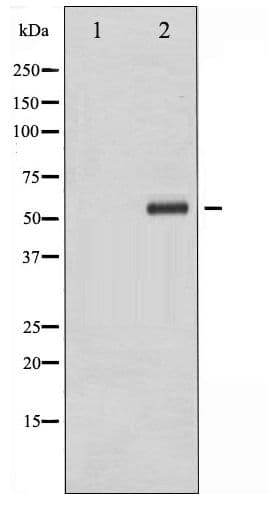 CHEK1 / CHK1 Antibody (phospho-Ser286)