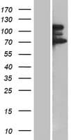 TP53BP2 / ASPP2 Protein (Over-Expression Lysate Myc-DDK (Flag))