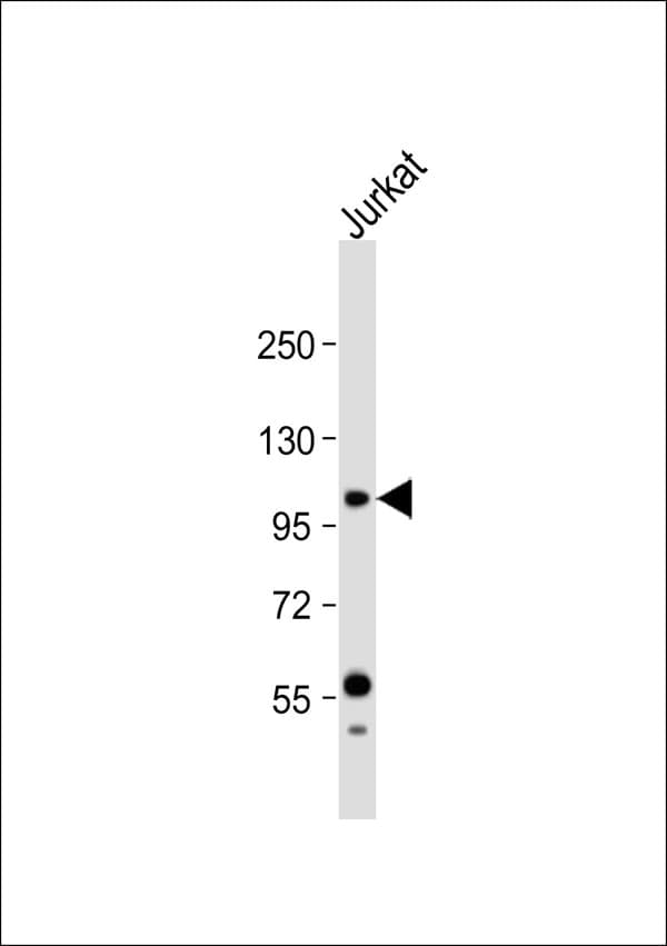 PIK3CG / PI3K Gamma Antibody