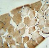 CDKN2C / p18 INK4c Antibody (aa113-139)