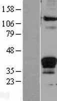 FASLG / Fas Ligand Protein (Over-Expression Lysate Myc-DDK (Flag))