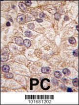 PI4K2B Antibody (aa1-30)