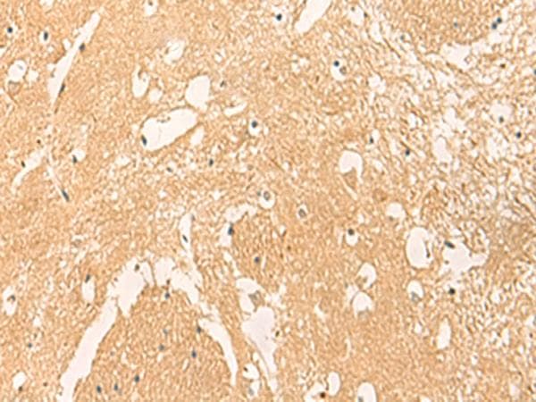 STK32C / PKE Antibody