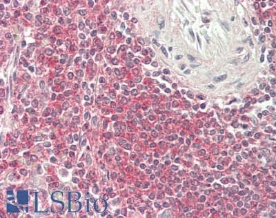 IHC-plus™ CD19 Antibody (clone 3G7)