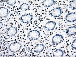 Monoclonal Mouse anti-Human CNDP1 Antibody (clone OTI2F8, IHC, WB)