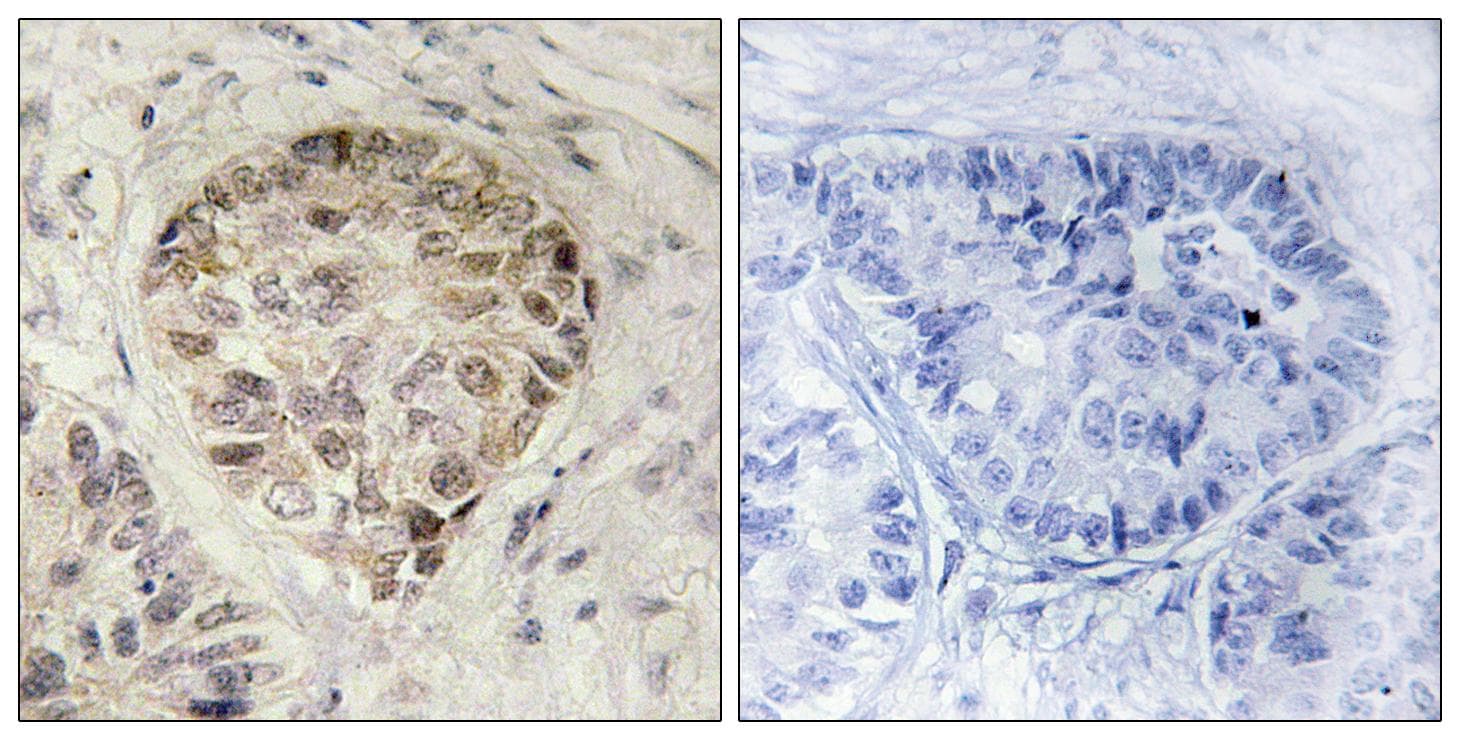 CENTB1 / ACAP1 Antibody (phospho-Ser554)