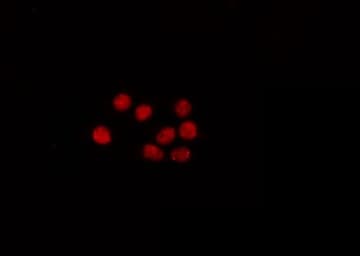 SP1 Antibody (phospho-Thr453)