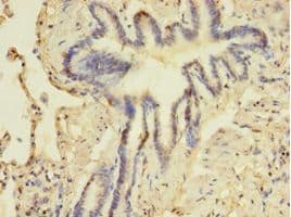 YWHAE / 14-3-3 Epsilon Antibody
