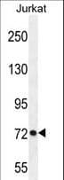 PCDHGC3 / PCDH2 Antibody (aa511-539)