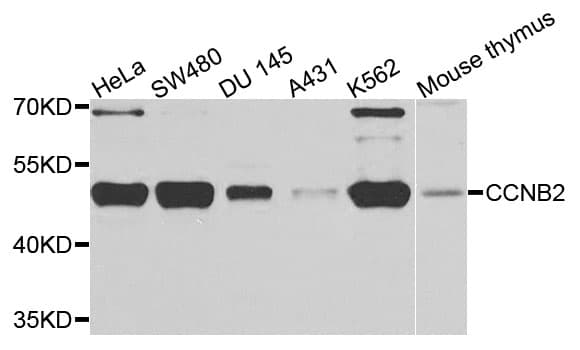 CCNB2 / Cyclin B2 Antibody