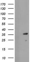 UBE2J1 Antibody (clone OTI3E6)