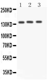 ACE / CD143 Antibody (aa130-144)