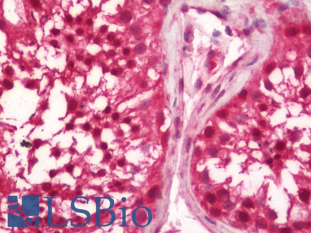 IHC-plus™ ESR2 / ER Beta Antibody