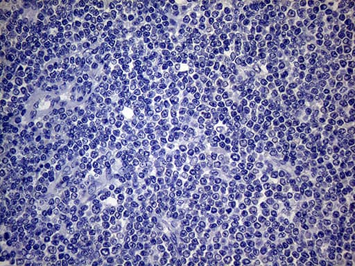 SCFD1 / SLY1 Antibody (aa66-190, clone OTI10D10)